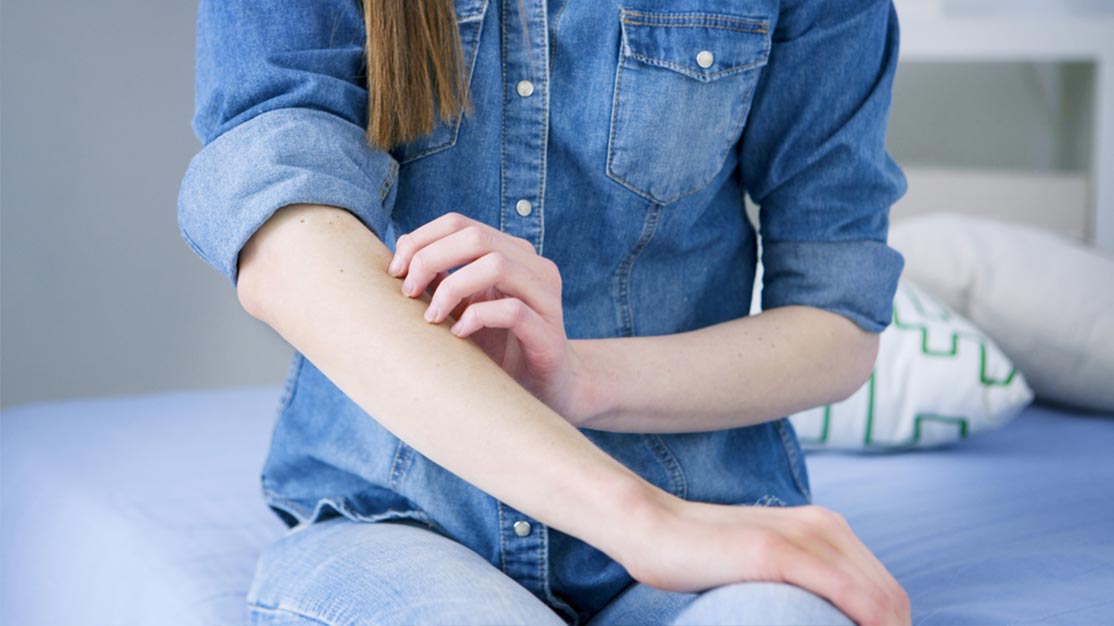 What is Psoriasis?